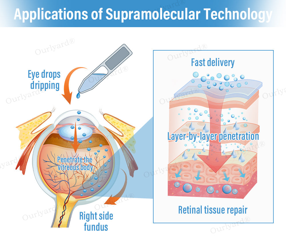 đŠââď¸OurlyardÂŽ Supramolecular Eye Drops â
Health Canada Approved (Suitable for cataracts, AMD, dry eye and presbyopia)
