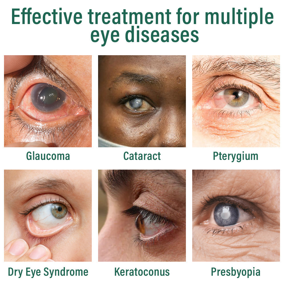 ✅Ourlyard® Nano Eye Drops Serum 👩⚕️Suitable for presbyopia, dry eye syndrome, glaucoma, and cataracts 🍁 🍁
