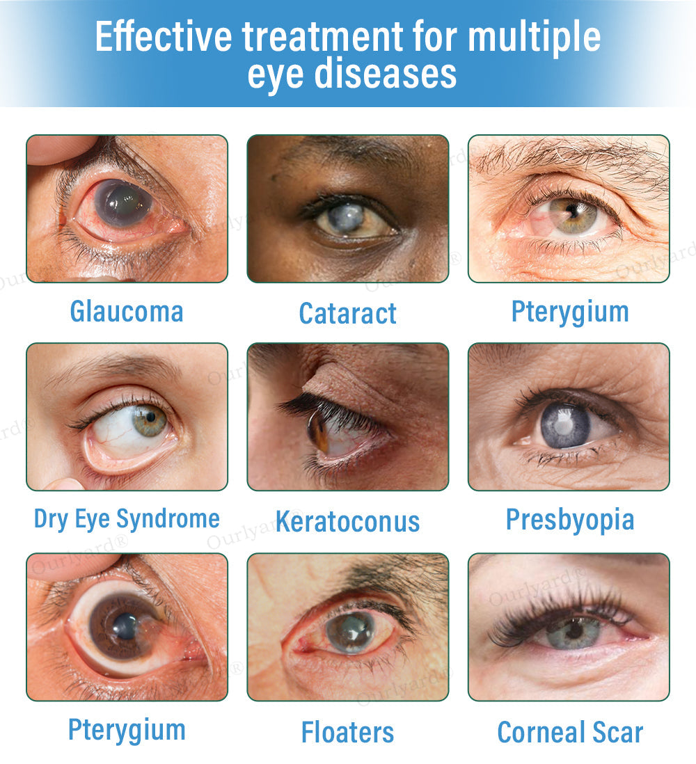 đŠââď¸OurlyardÂŽ Supramolecular Eye Drops â
Health Canada Approved (Suitable for cataracts, AMD, dry eye and presbyopia)