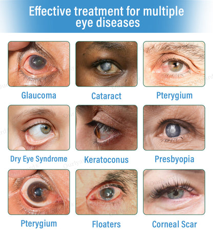 👩‍⚕️Ourlyard® Supramolecular Eye Drops ✅Health Canada Approved (Suitable for cataracts, AMD, dry eye and presbyopia)